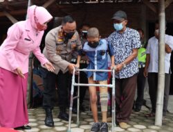 Harus Diamputasi Akibat Kanker Tulang, Kiki Kini Bisa Jalan Lagi Berkat Kaki Palsu Pemberian Kapolres Demak